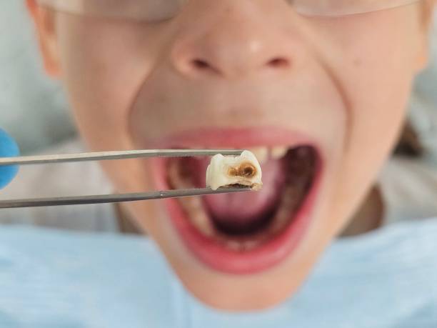 Best Emergency Care for Gum Disease in Elmwood, LA